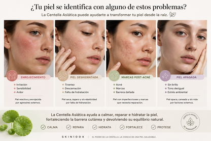🇰🇷✨ SKIN1004 Madagascar Centella Ampoule 55 ml | Sérum Calmante e Hidratante | Skincare Coreano Original