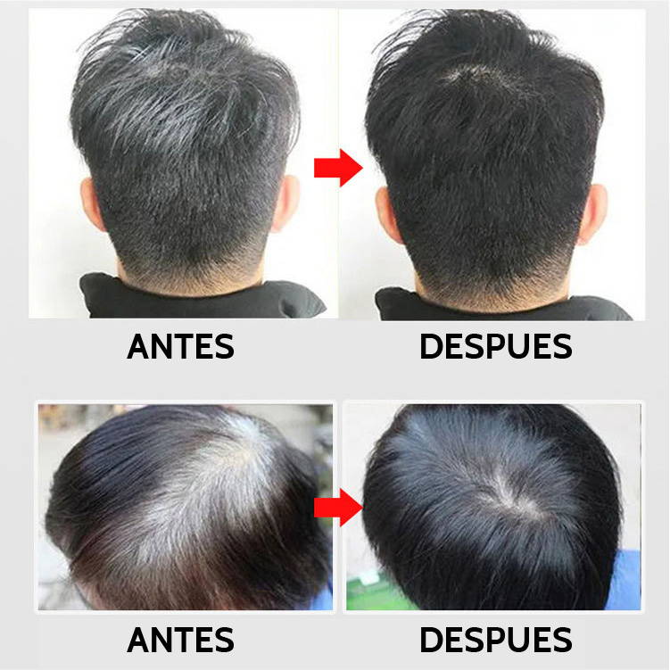 Kit 2x Shampoo Tinturador Negro Natural con Argán | Cobertura de Canas Instantánea y Nutrición Profunda | 420 ml Copacabana  (Incluye de REGALO: Manual de aplicación + Par de guantes) (Copia)