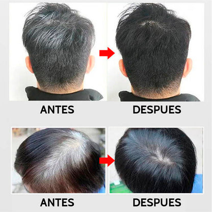 Kit 2x Shampoo Tinturador Negro Natural con Argán | Cobertura de Canas Instantánea y Nutrición Profunda | 420 ml Copacabana  (Incluye de REGALO: Manual de aplicación + Par de guantes) (Copia)